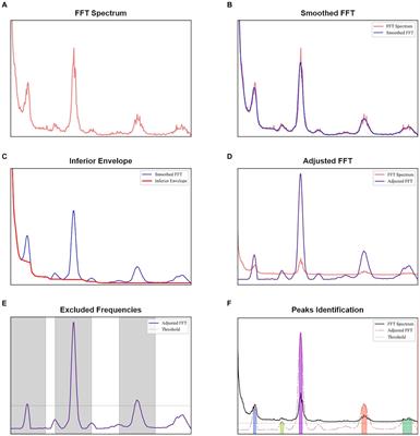 Characterization of pulsations in the brain and cerebrospinal fluid using ultra-high field magnetic resonance imaging